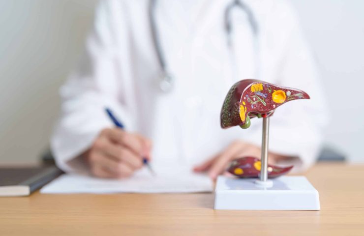 Doctor with human Liver anatomy model. Liver cancer and Tumor, J