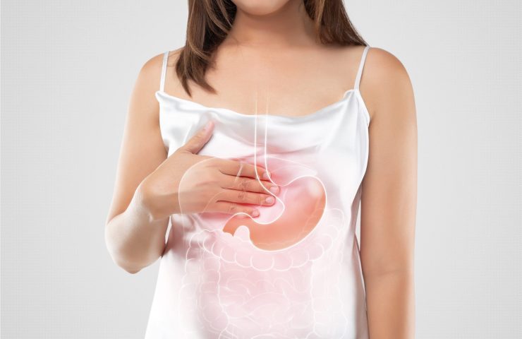 A woman suffering from gastroesophageal reflux disease